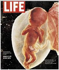 1965, la revista life publica la primera fotografía de un feto dentro del seno materno