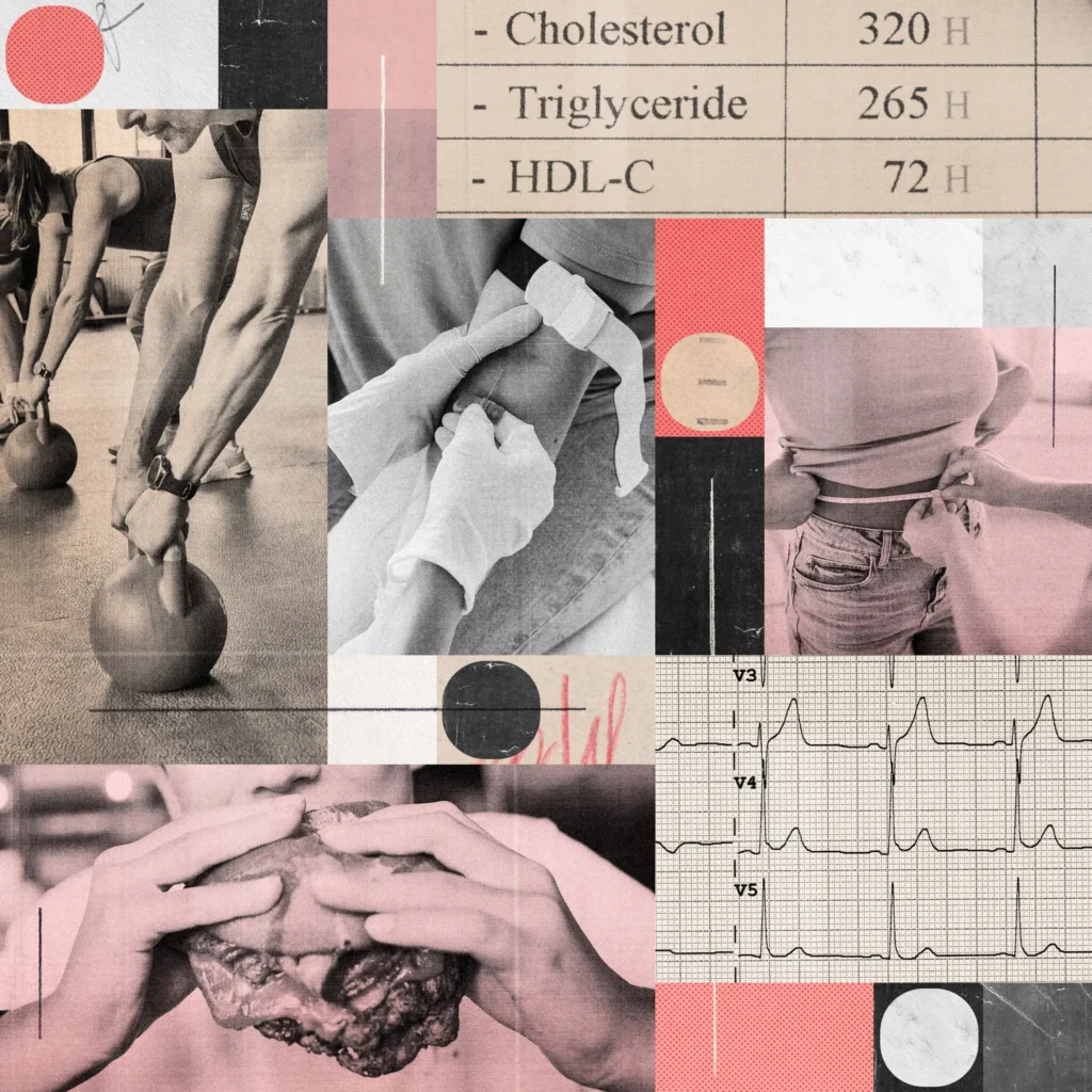 Confused about the new cholesterol guidelines? here’s what to know