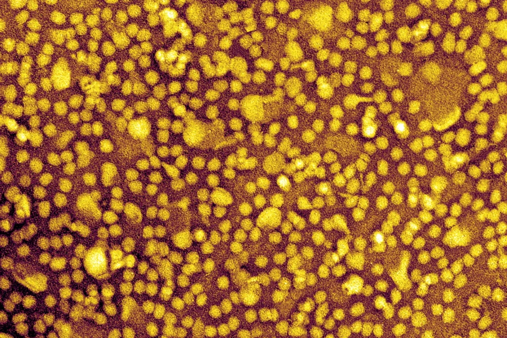 One and done heart disease prevention? scientists show it may be posible