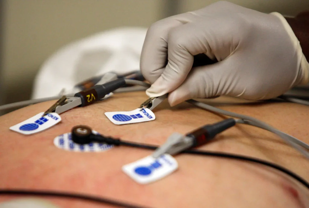 Doctors thought it was asthma. A.I. flagged a serious heart problem