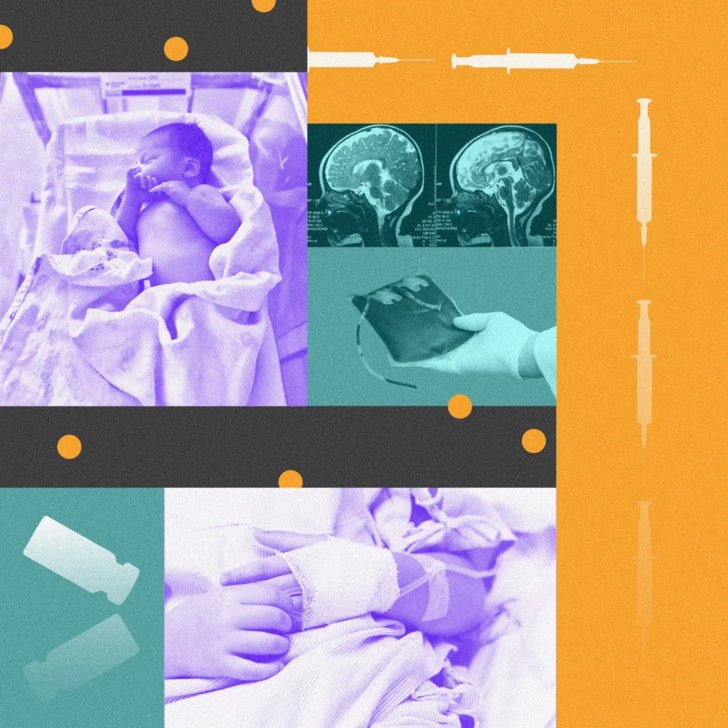 Hospitals see diseases resurge as vaccinations decline