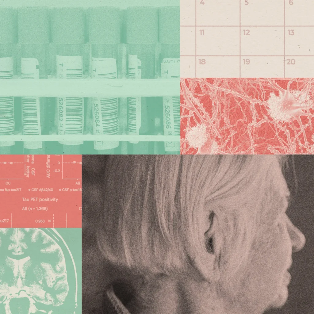Alzheimer’s blood tests offer new promise to diagnose and predict the disease