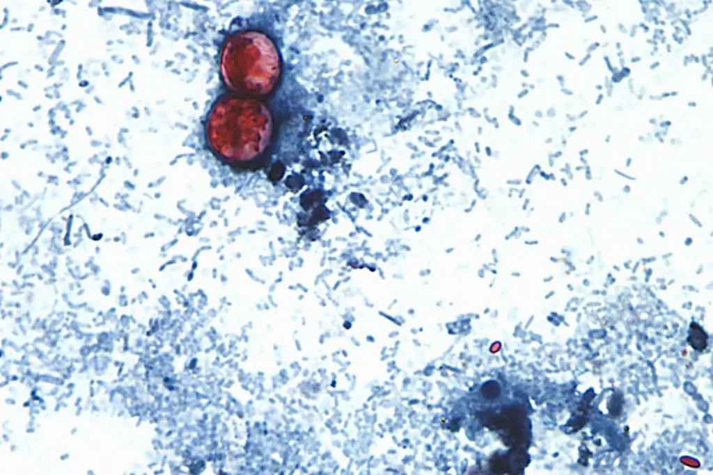 Cyclospora spreads through human feces. How did it get into our food supply?