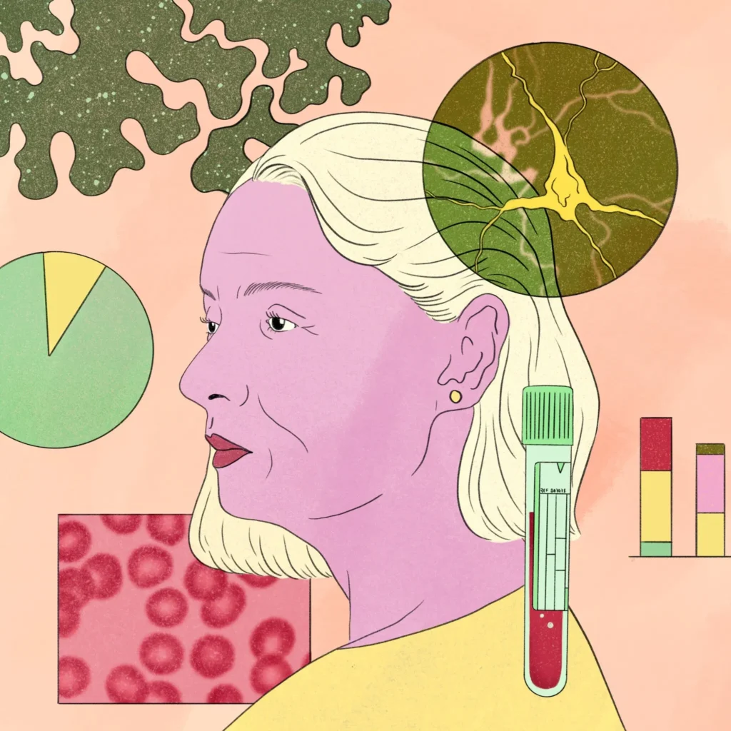 Blood tests to predict Alzheimer’s are causing confusion and distress